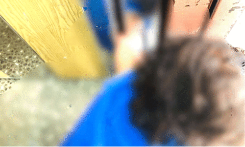 കു​ട്ടി​യു​ടെ കൈ ​ലി​ഫ്റ്റി​ൽ കു​ടു​ങ്ങി