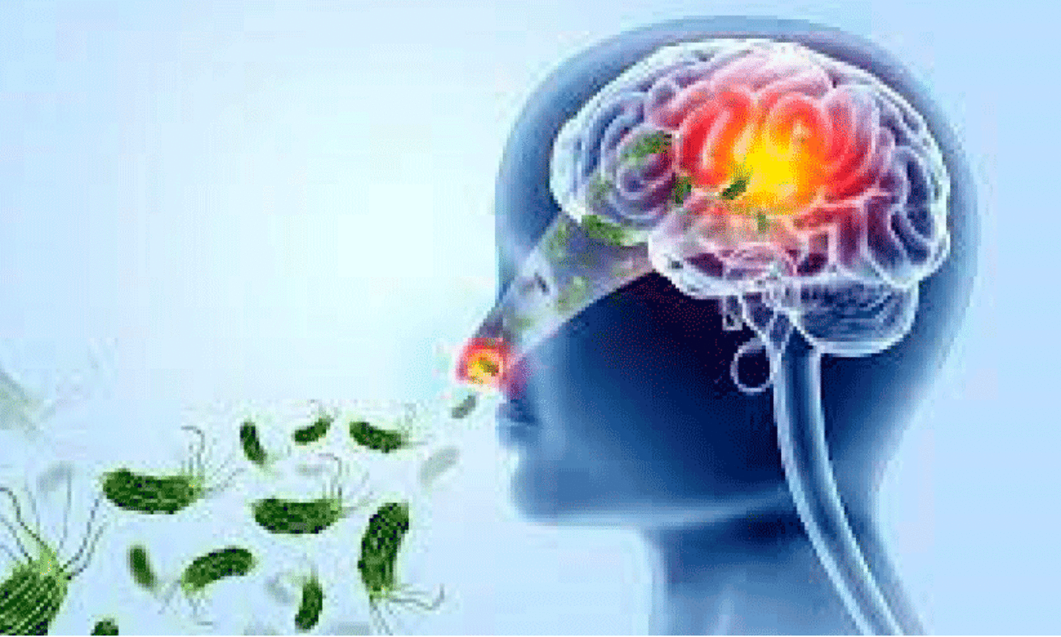 Amoebic encephalitis