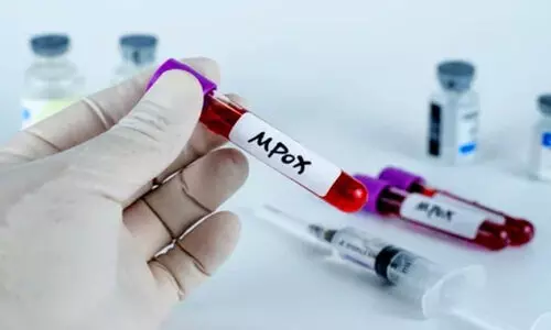 ഇന്ത്യയില്‍ എംപോക്‌സ് ഇല്ലെന്ന് കേന്ദ്ര ആരോഗ്യമന്ത്രാലയം