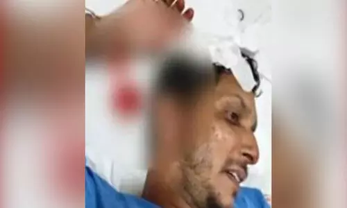 കണ്ണൂർ കല്യാശ്ശേരിയിൽ ബി.ജെ.പി പ്രവർത്തകന് വെട്ടേറ്റു