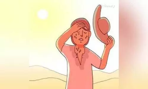 ആ​ശ്വാ​സം; വെ​ള്ളി​യാ​ഴ്ച​യോ​ടെ ഉ​ഷ്ണം കു​റ​യും