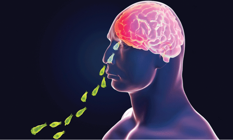 അമീബിക് മസ്തിഷ്ക ജ്വരം മരണകാരണമാകുമോ? അറിയാം, അമീബിക് മസ്തിഷ്ക ജ്വരത്തെ കുറിച്ച്