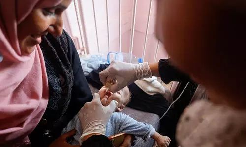 ആക്രമണത്തിനിടെ ഗസ്സയിൽ പോളിയോ തുള്ളിമരുന്ന് വിതരണത്തിന് തുടക്കം