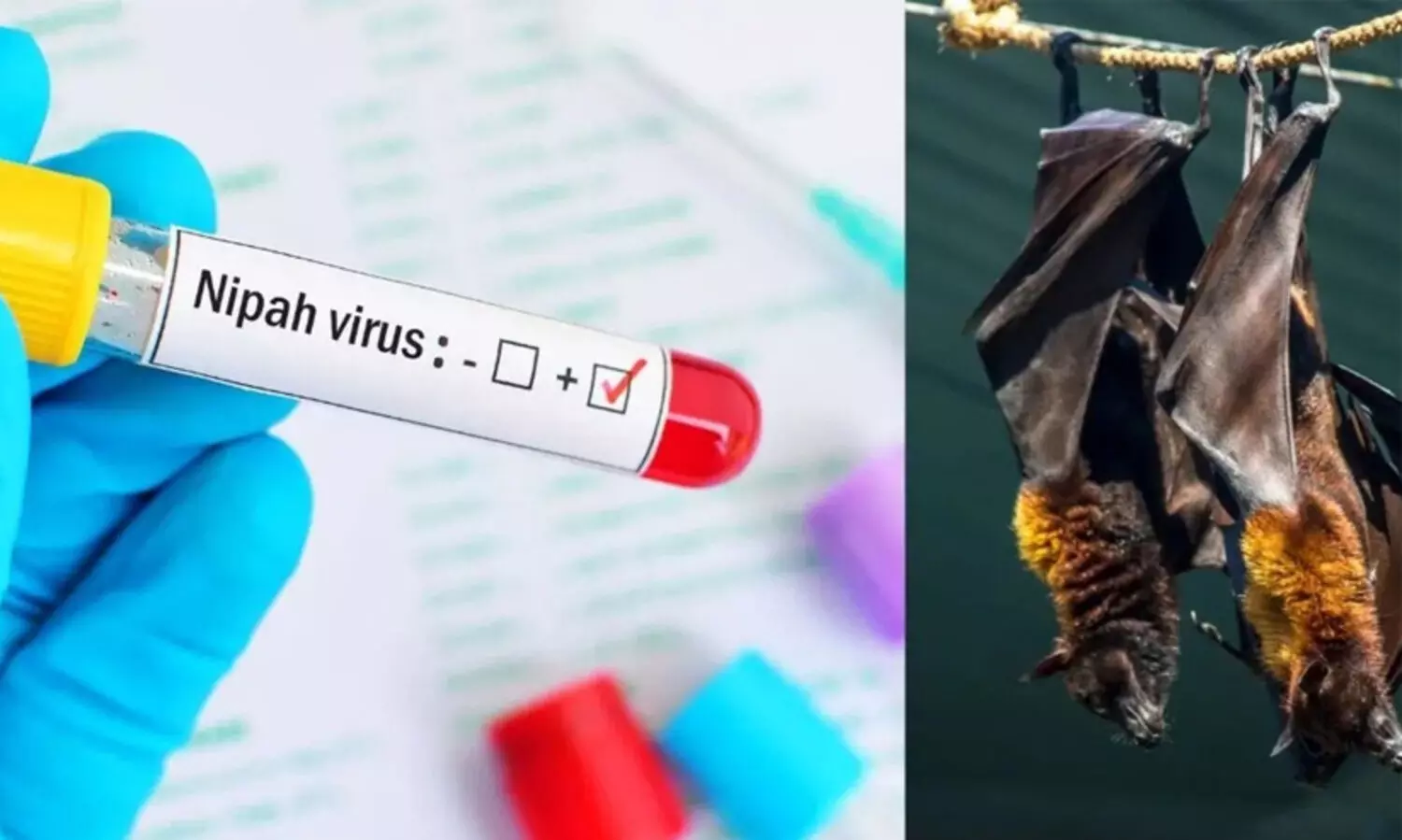 മലപ്പുറത്ത് നിപ സ്ഥിരീകരിച്ചു; മരിച്ച 24കാരന്‍റെ ഫലം പോസിറ്റീവ്