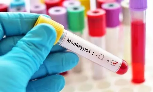 കേരളത്തിൽ എംപോക്സ് സ്ഥിരീകരിച്ചു; മലപ്പുറം സ്വദേശിയുടെ പരിശോധനാഫലം പോസിറ്റിവ്