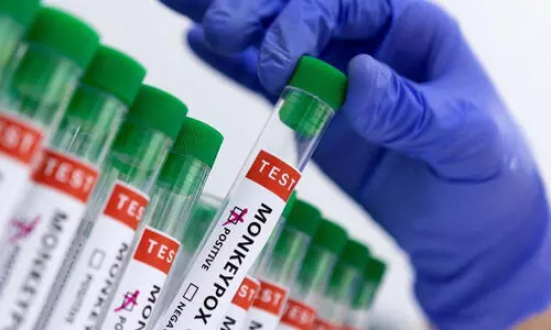 കേരളത്തില്‍ ഒരാള്‍ക്കുകൂടി എം പോക്‌സ് സ്ഥിരീകരിച്ചു