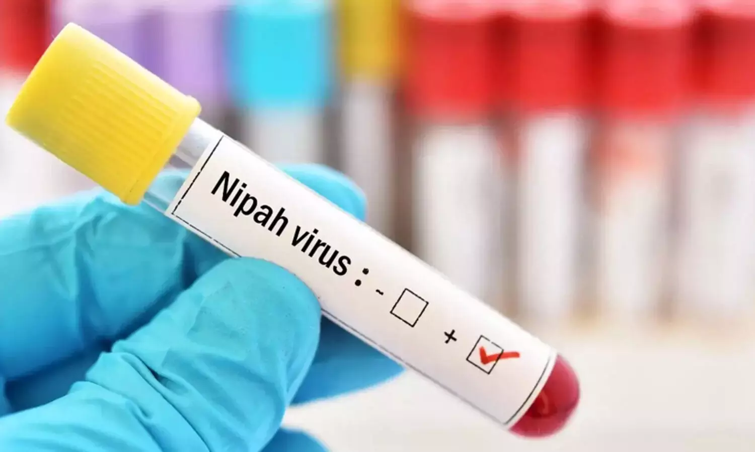 നിപ: 16 പേരുടെ പരിശോധനഫലം കൂടി നെഗറ്റീവ്; മലപ്പുറം ജില്ലയിലെ നിയന്ത്രണങ്ങൾ പിൻവലിച്ചു