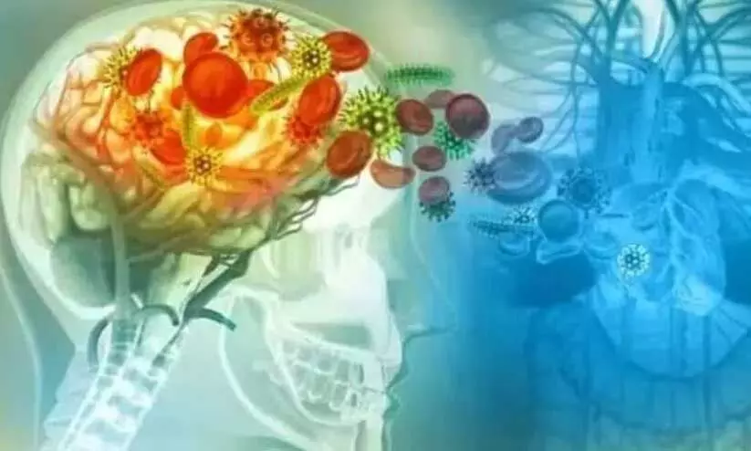 Amoebic encephalitis Amoebic encephalitis