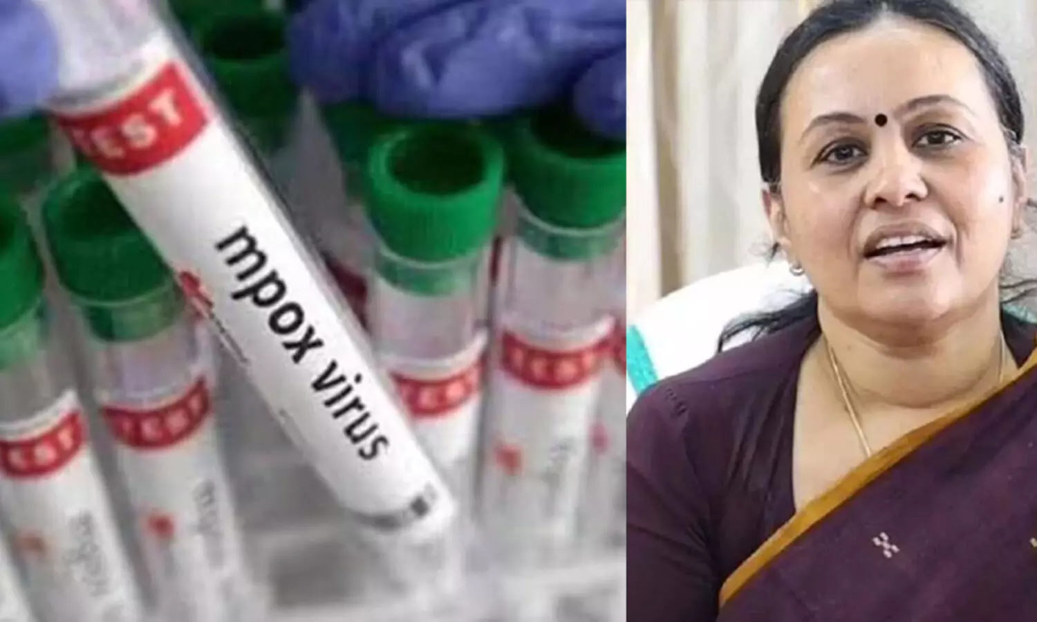 എം പോക്സ്-രോഗ ലക്ഷണങ്ങൾ ഉള്ളവർ കൃത്യമായ ചികിത്സ തേടണം-വീണ ജോര്‍ജ്