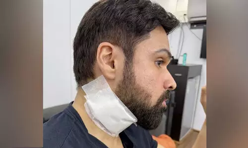 സ്റ്റണ്ട് രംഗം ചിത്രീകരിക്കുന്നതിനിടെ നടൻ ഇമ്രാൻ ഹാഷ്മിക്ക് പരിക്ക്