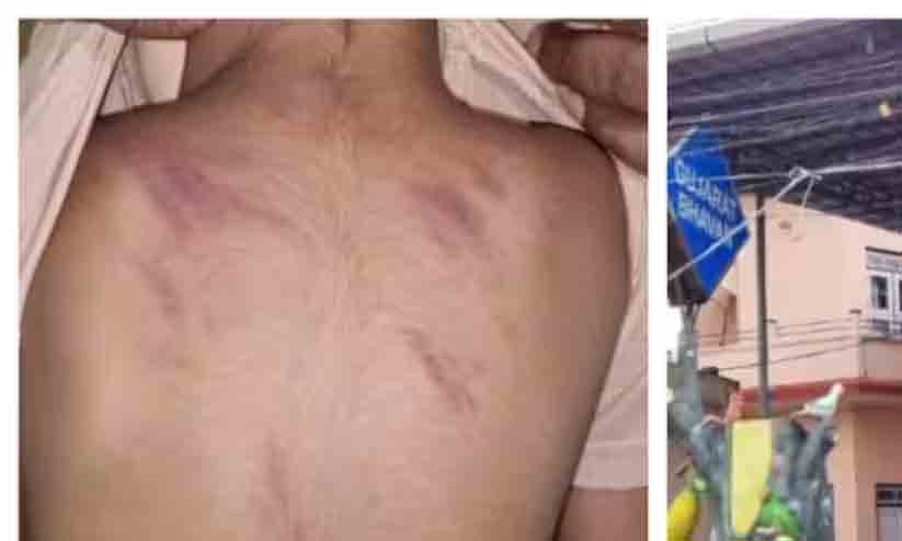 മൂന്നര വയസ്സുകാരനെ ക്രൂരമായി മർദിച്ചു; കൊച്ചിയിൽ ​പ്ലേ സ്കൂൾ അധ്യാപിക അറസ്റ്റിൽ