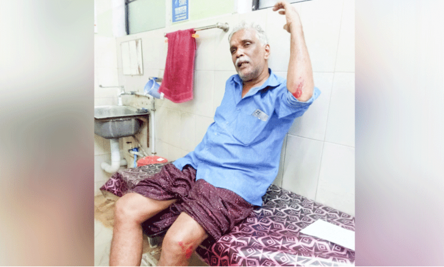 കാട്ടുപന്നി ആക്രമണം: ക്ഷീരകർഷകന്​ പരിക്ക്