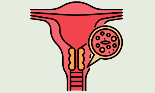 ​സെ​ർ​വി​ക്ക​ൽ കാ​ൻ​സ​റി​ന് പു​തി​യ ചി​കി​ത്സാ​രീ​തി; മ​ര​ണ​നി​ര​ക്ക് 40% വ​രെ കു​റക്കാം