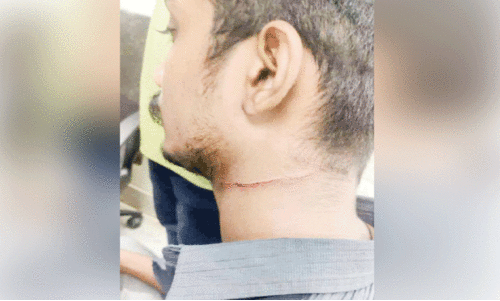 ഹോട്ടലിൽ കയറി ജീവനക്കാരനെ ആക്രമിച്ചു