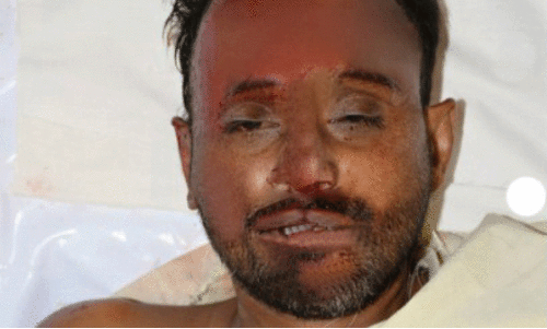 മൃതദേഹം മൃതദേഹം