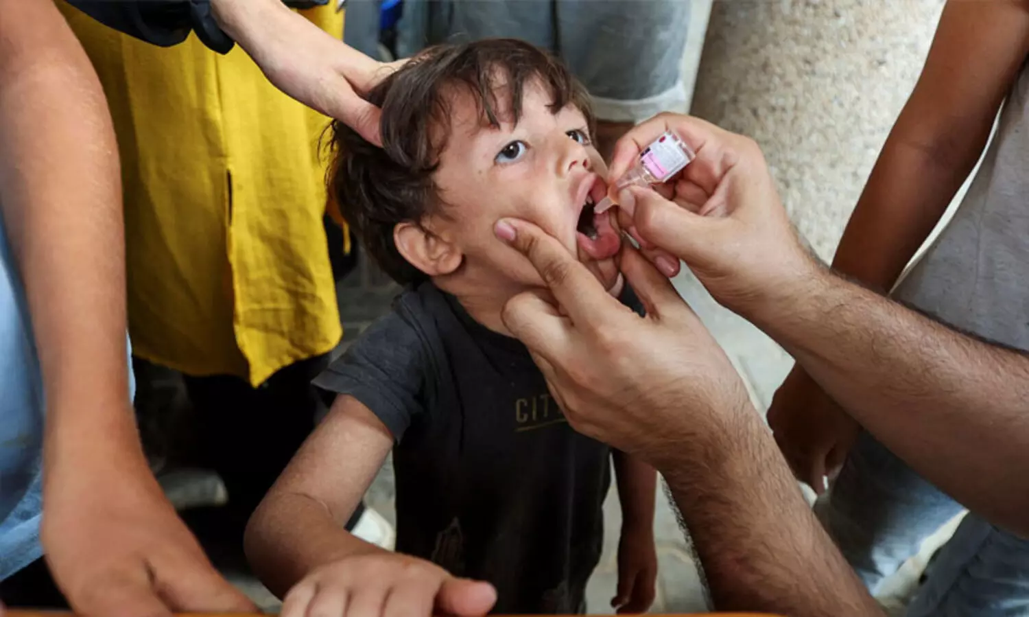 വടക്കൻ ഗസ്സയിൽ പോളിയോ വാക്സിനേഷൻ പുനഃരാരംഭിച്ചു