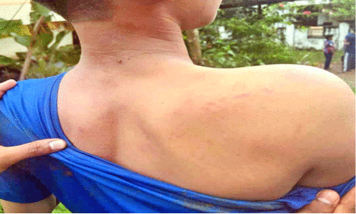 യു​വാ​ക്ക​ൾ ചേ​ർ​ന്ന് വി​ദ്യാ​ർ​ഥി​യെ ക്രൂ​ര​മാ​യി മ​ർ​ദി​ച്ചു