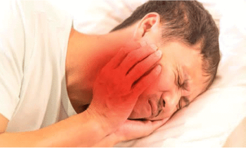 തൃക്കാക്കരയിൽ മുണ്ടിനീര് വ്യാപകമാകുന്നു