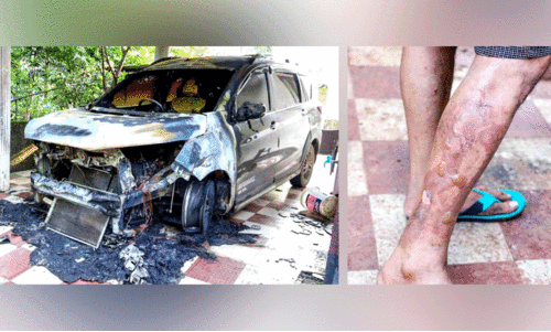 ആലംകോട് വീടിനുനേരെ പെട്രോൾ ബോംബേറ്​; കാർ കത്തി