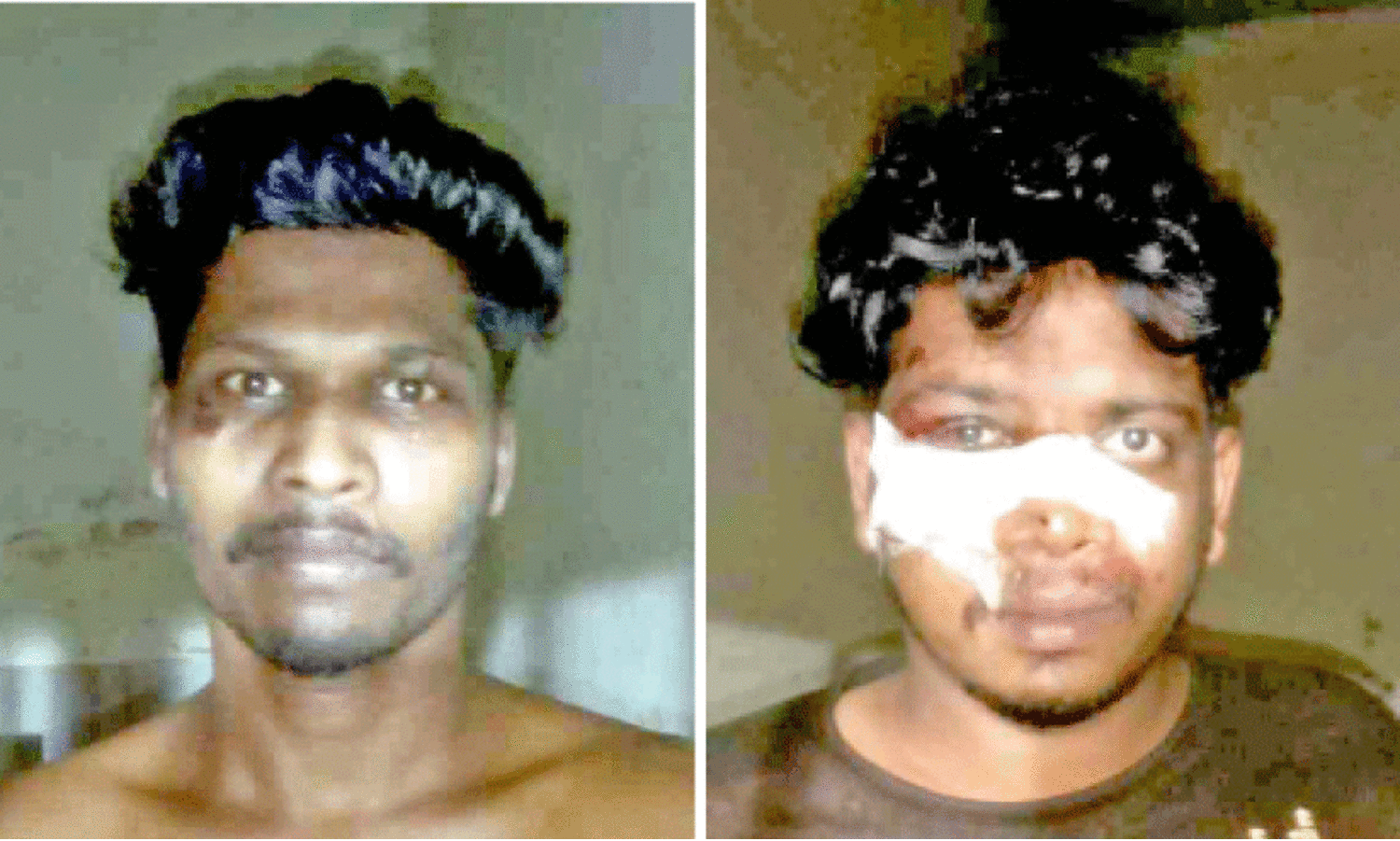 മദ്യപാനത്തിനിടെ വാക്കേറ്റം: യുവാവിന് കുത്തേറ്റു; രണ്ടു പേർ അറസ്റ്റിൽ