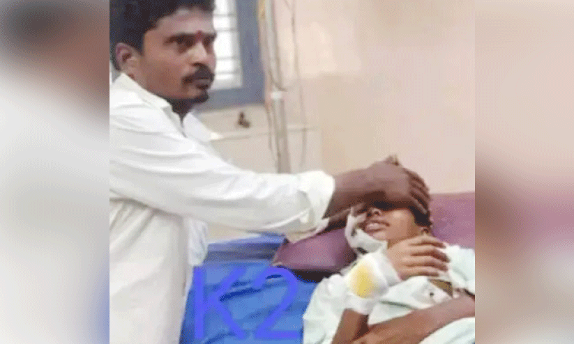 റെ​യ്ച്ചൂ​രി​ൽ തെ​രു​വ് നാ​യു​ടെ ആ​ക്ര​മ​ണ​ത്തി​ൽ കു​ട്ടി​ക്ക് ഗു​രു​ത​ര പ​രി​ക്ക്