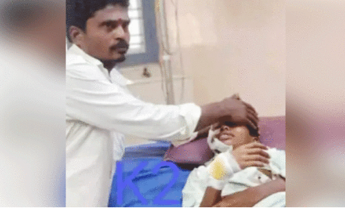 റെ​യ്ച്ചൂ​രി​ൽ തെ​രു​വ് നാ​യു​ടെ ആ​ക്ര​മ​ണ​ത്തി​ൽ കു​ട്ടി​ക്ക് ഗു​രു​ത​ര പ​രി​ക്ക്