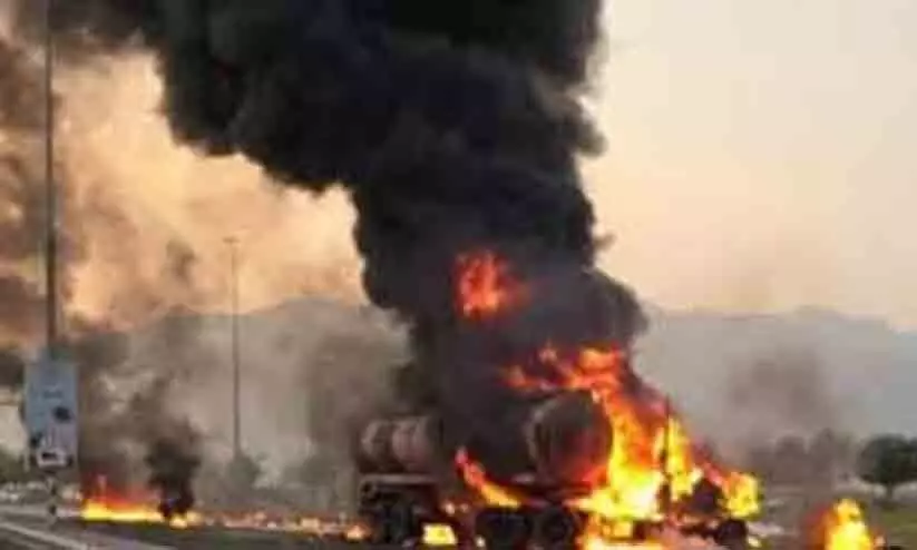 Representative Image