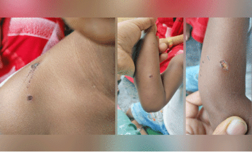 പൊഴുതനയിൽ തെരുവുനായ് ശല്യം, നിരവധി പേർക്ക് കടിയേറ്റു പൊഴുതനയിൽ തെരുവുനായ് ശല്യം, നിരവധി പേർക്ക് കടിയേറ്റു