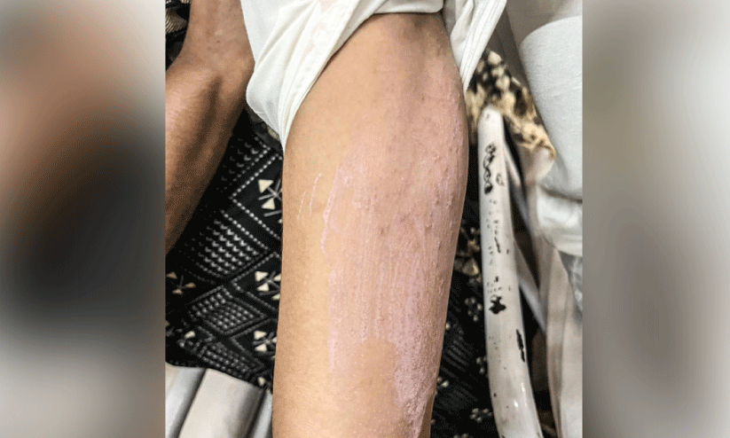 Alappuzha General Hospital Alappuzha General Hospital