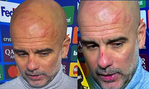 ചാമ്പ്യൻസ് ലീഗിലെ ഞെട്ടിക്കുന്ന സമനില; മുഖത്ത് സ്വയം മുറിവേൽപ്പിച്ച് പെപ് ചാമ്പ്യൻസ് ലീഗിലെ ഞെട്ടിക്കുന്ന സമനില; മുഖത്ത് സ്വയം മുറിവേൽപ്പിച്ച് പെപ്