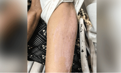 Alappuzha General Hospital