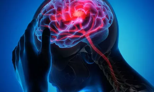 എന്താണ് സ്​ട്രോക്ക്? എങ്ങനെ നേരിടാം?