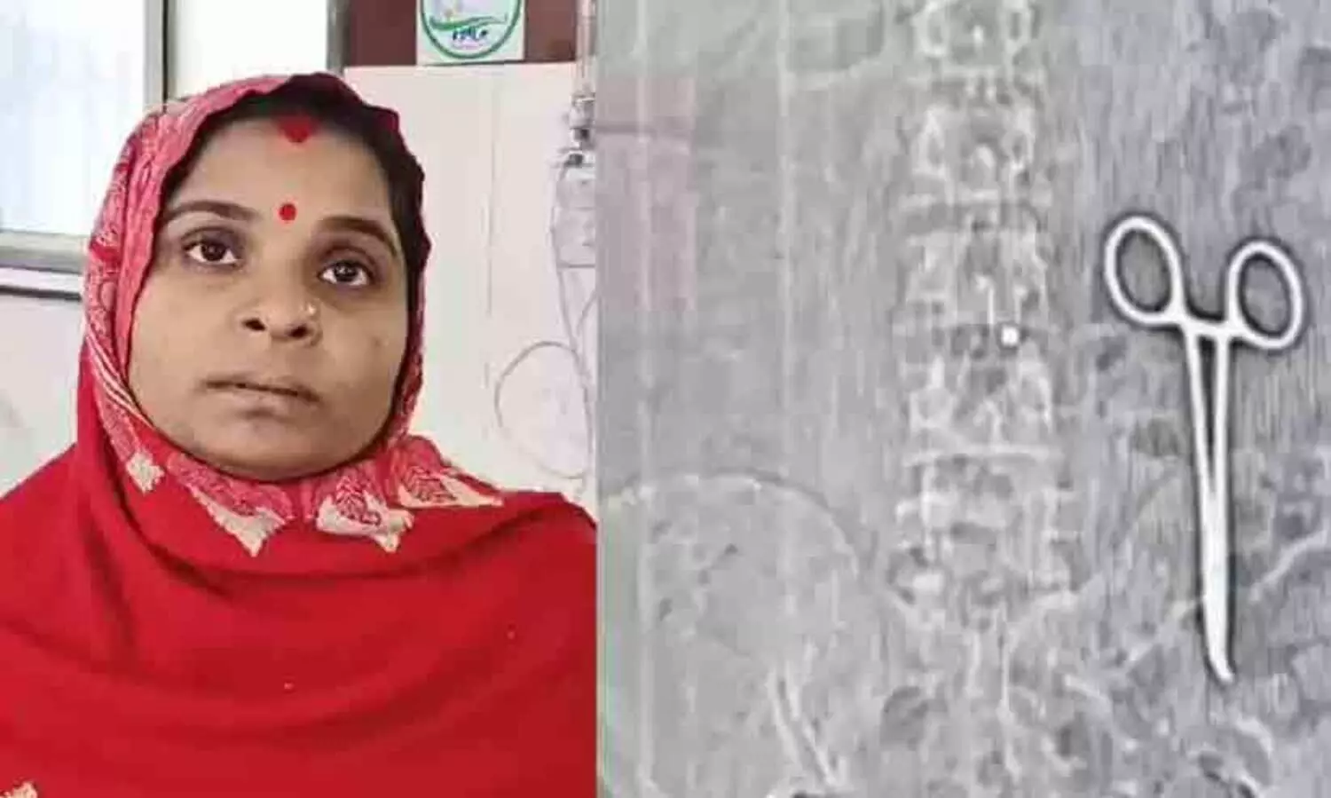 scissors stuck in woman stomach