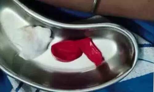 ബലൂൺ തൊണ്ടയിൽ കുടുങ്ങി ഏഴാംക്ലാസുകാരൻ മരിച്ചു