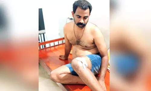 തൃക്കാക്കരയിൽ തെരുവുനായ്​ ശല്യം രൂക്ഷമാകുന്നു; രണ്ടു പേർക്ക് കടിയേറ്റു