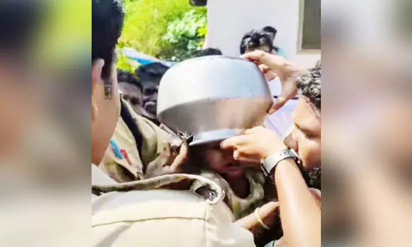 ഒ​ന്ന​ര വ​യ​സ്സു​കാ​രി​യു​ടെ ത​ല ക​ല​ത്തി​ൽ കു​ടു​ങ്ങി; ര​ക്ഷ​ക​രാ​യി അ​ഗ്നി​ര​ക്ഷ​സേ​ന