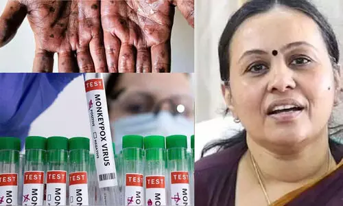 കണ്ണൂരിൽ ഒരാൾക്കുകൂടി എം പോക്സ് സ്ഥിരീകരിച്ചു; ചികിത്സയിലുള്ളയാളുടെ നില തൃപ്തികരം