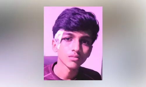 ഫുട്ബാൾ ഫൈനലിനിടെ പടക്കംപൊട്ടി കുട്ടിക്ക് പരിക്ക് ഫുട്ബാൾ ഫൈനലിനിടെ പടക്കംപൊട്ടി കുട്ടിക്ക് പരിക്ക്