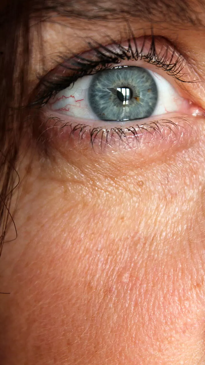 പ്ര​മേഹ​വും നേ​ത്ര ആ​രോ​ഗ്യ​വും..