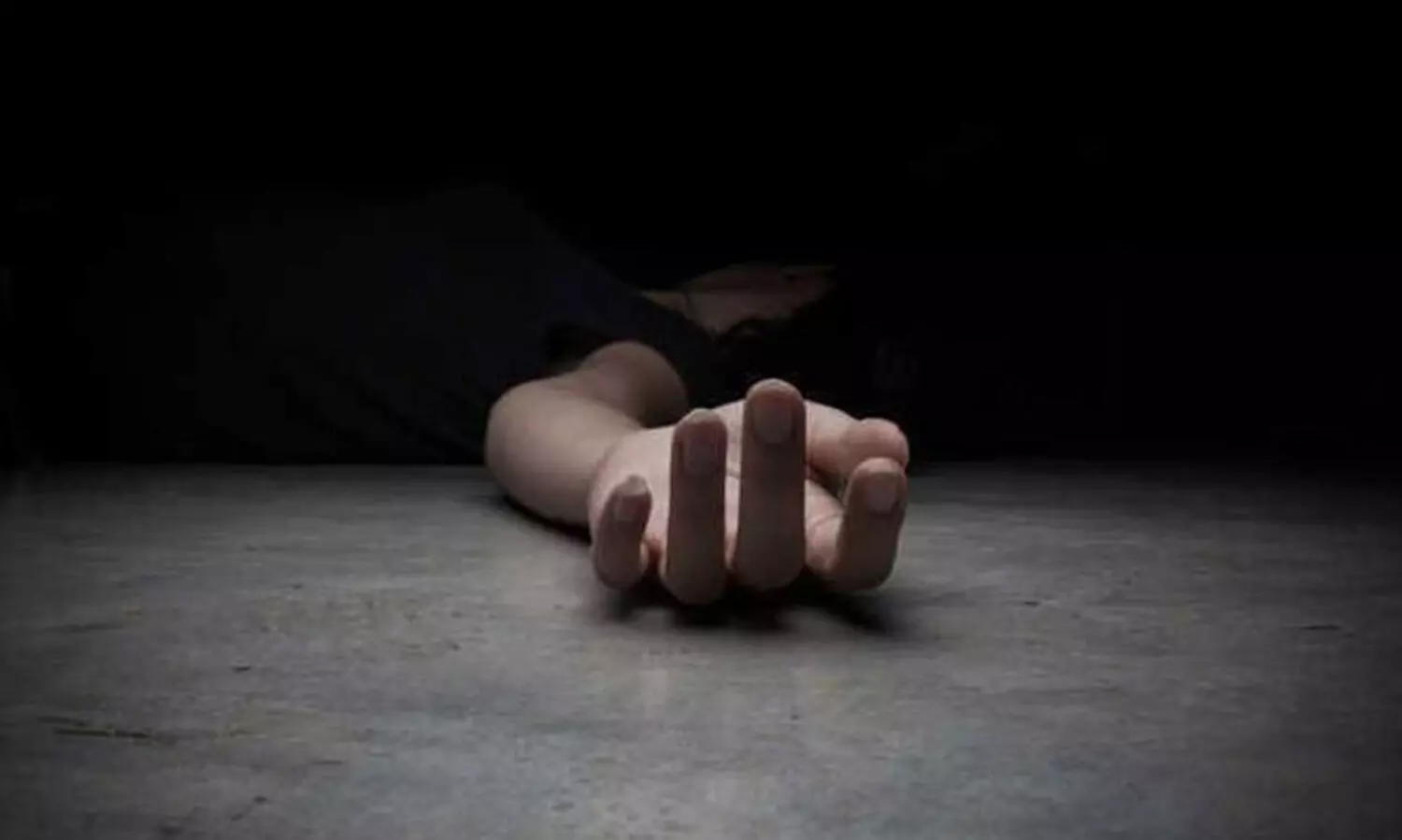 Representation Image