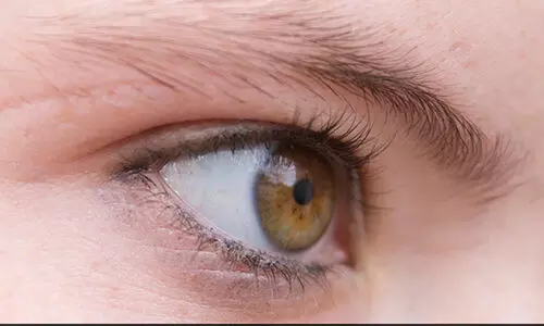 ശസ്ത്രക്രിയാ പിഴവ്; യുവതിയുടെ കണ്ണിന്റെ കാഴ്ച നഷ്ട്ടപ്പെട്ടു