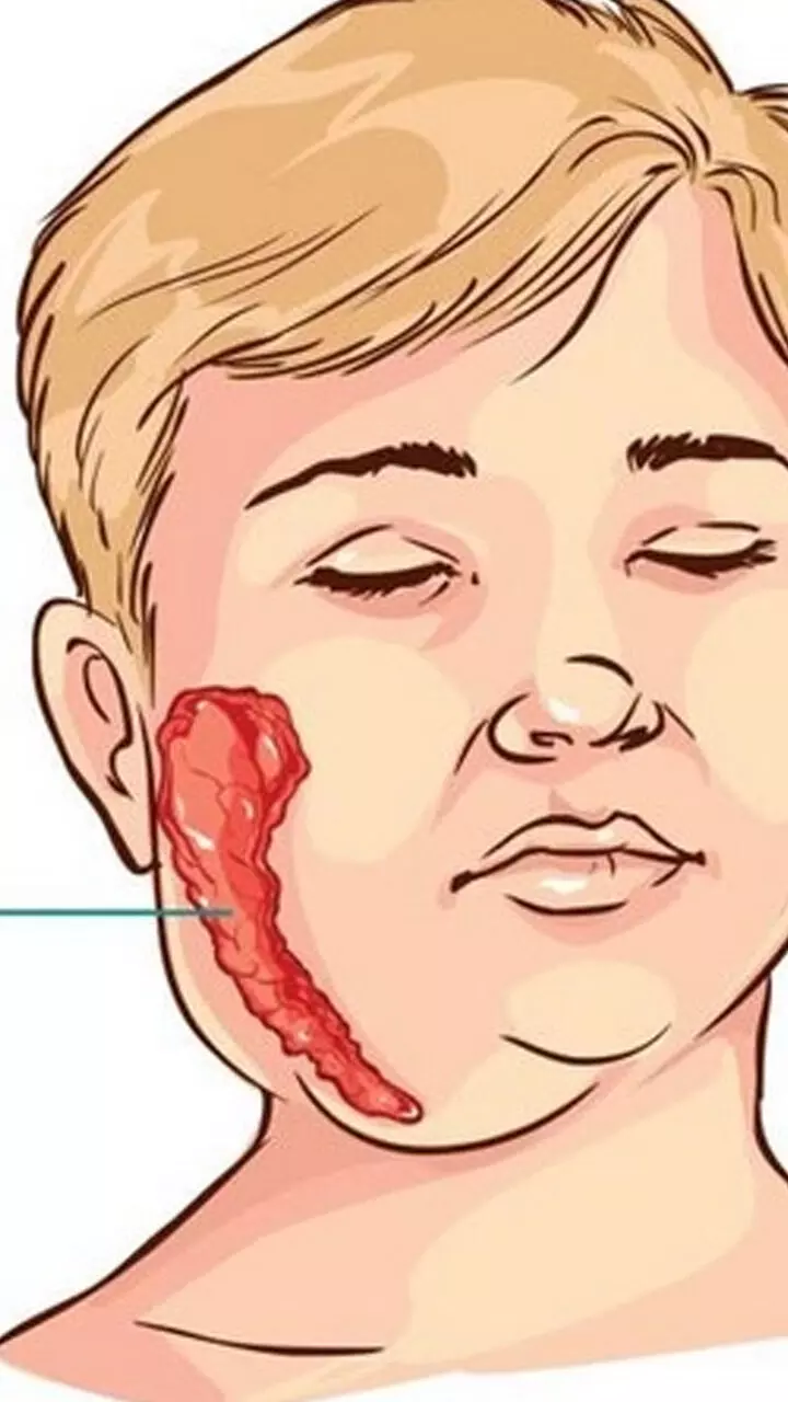 പ​ട​ർ​ന്നു​പി​ടി​ക്കുന്ന മു​ണ്ടി​നീ​ര് (മം​സ്)