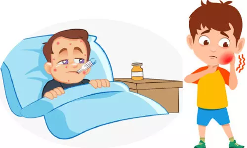 മ​ഞ്ഞും വെ​യി​ലും; വില്ലനായി പനി; കുട്ടികളില്‍   മുണ്ടിനീര് വ്യാപകം