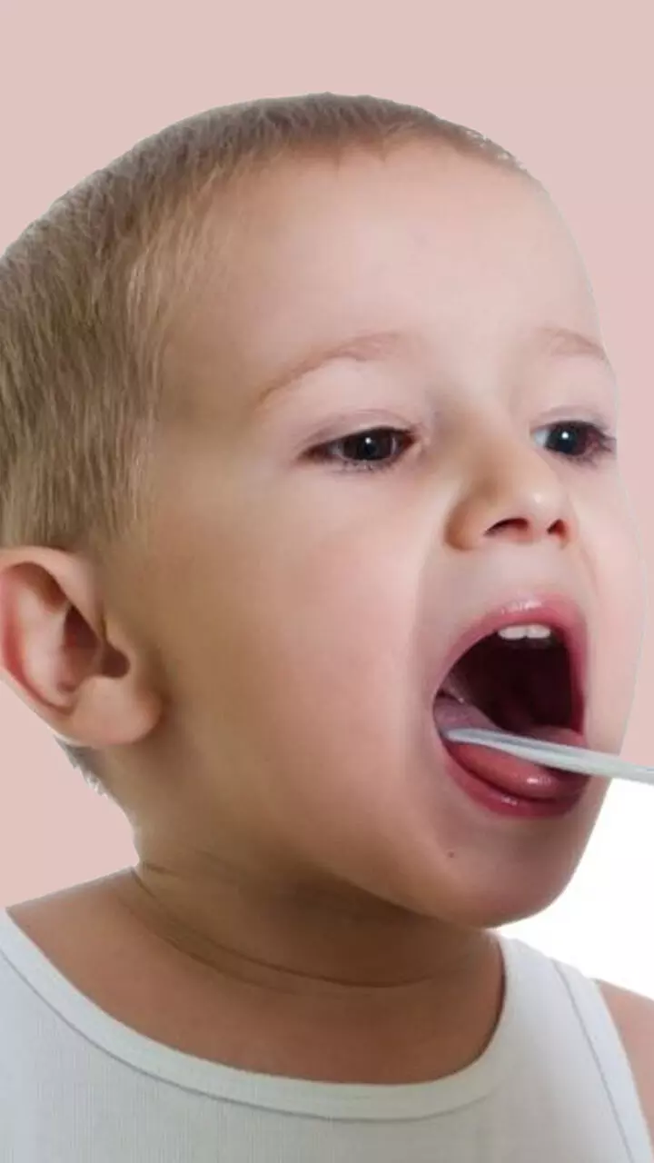 കാ​ലാ​വ​സ്ഥ; ടോ​ൺ​സി​ലൈ​റ്റി​സ് രോ​​ഗം വ​ർ​ധി​ക്കു​ന്നു