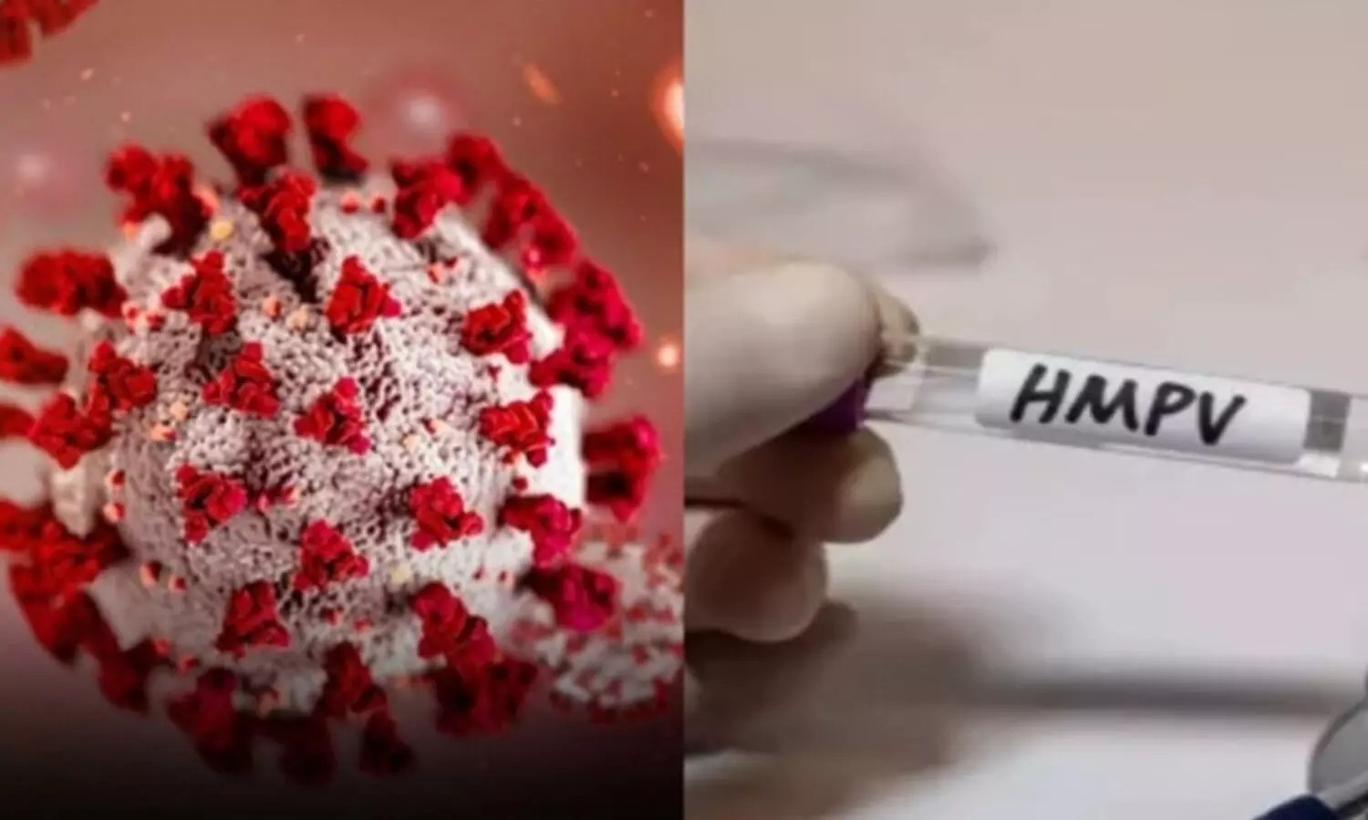 ചെന്നൈയിലും എച്ച്.എം.പി.വി വൈറസ് ബാധ; രണ്ടു കുട്ടികളിൽ രോഗം; ഇന്ത്യയിൽ അഞ്ചു കേസുകൾ