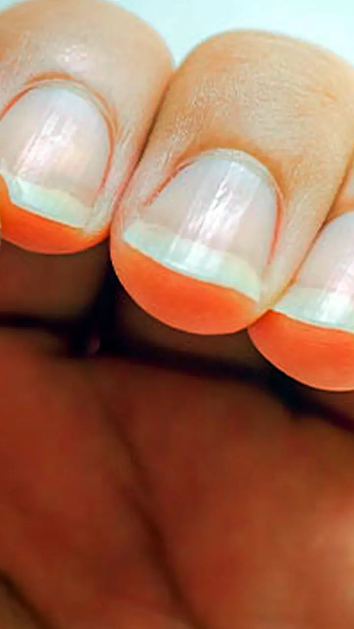 വ്യത്യസ്ത തരത്തിലുള്ള നഖങ്ങൾ സൂചിപ്പിക്കുന്നത് എന്താണ്; ചുമ്മ തള്ളികളയേണ്ട