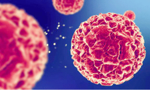 എ.​ഐ വി​ദ്യ​യി​ൽ അ​ർ​ബു​ദം നേ​ര​ത്തേ തി​രി​ച്ച​റി​യാം