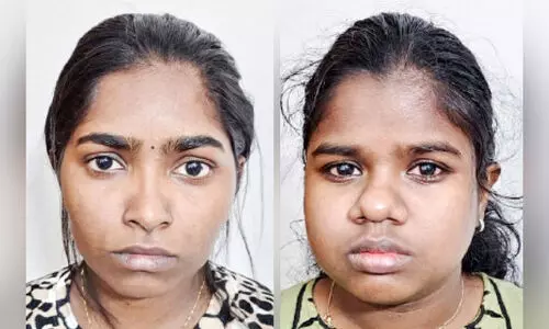 രാസലഹരിയുമായി യുവതികൾ പിടിയിൽ