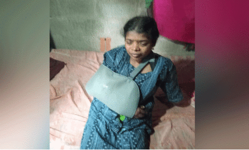 കാ​ട്ടു​പ​ന്നി ആ​ക്ര​മ​ണം: കൂ​ട​ര​ഞ്ഞി​യി​ൽ കാ​ൽന​ട​യാ​ത്രി​ക​ക്ക് പ​രി​ക്ക്