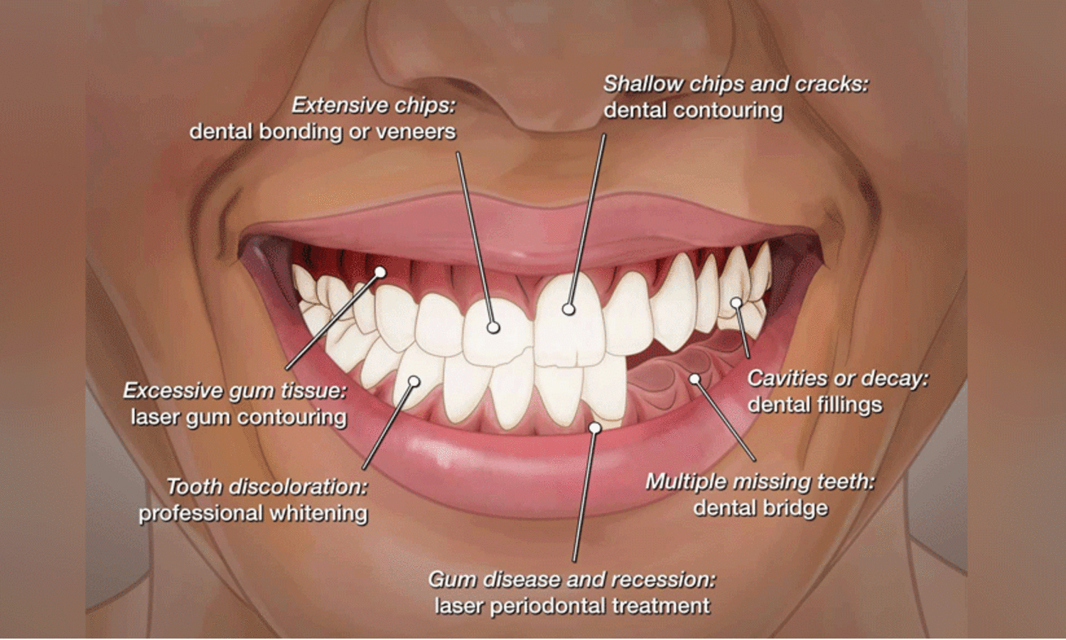 ഇനി ചിരിക്കാം ആത്മവിശ്വാസത്തോടെ